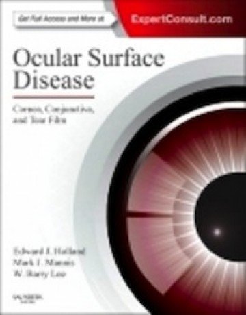 Ocular Surface Disease Book Cover