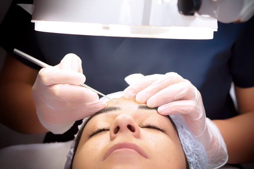 Oculoplastics surgery Oculoplastics surgery