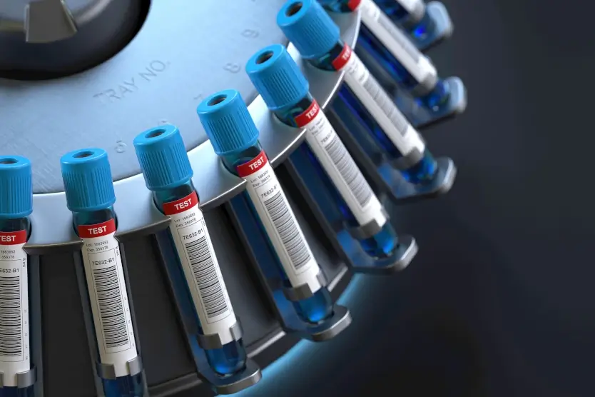 Autologous Serum Drops Save You from Dry Eyes Autologous Serum Drops Save You from Dry Eyes